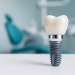 (Ua) Імпланти Neodent: швейцарська якість для вашої посмішки